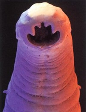 file/stat_i/ankilostoma.jpg