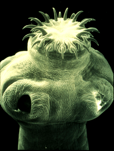 file/stat_i/difilobotrioz.gif